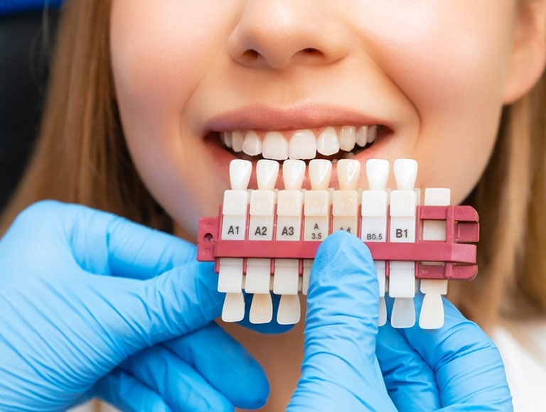 Ready for a Smile Makeover